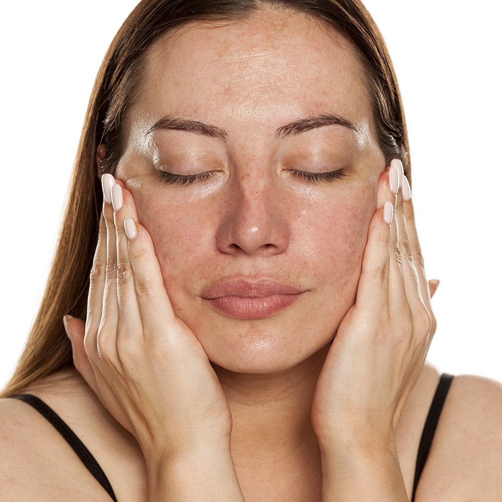 Micro Channeling for Hair Rejuvenation