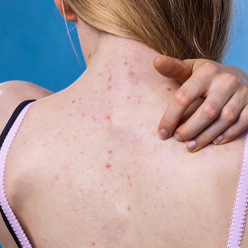 back facial Cottonwood and Sedona AZ