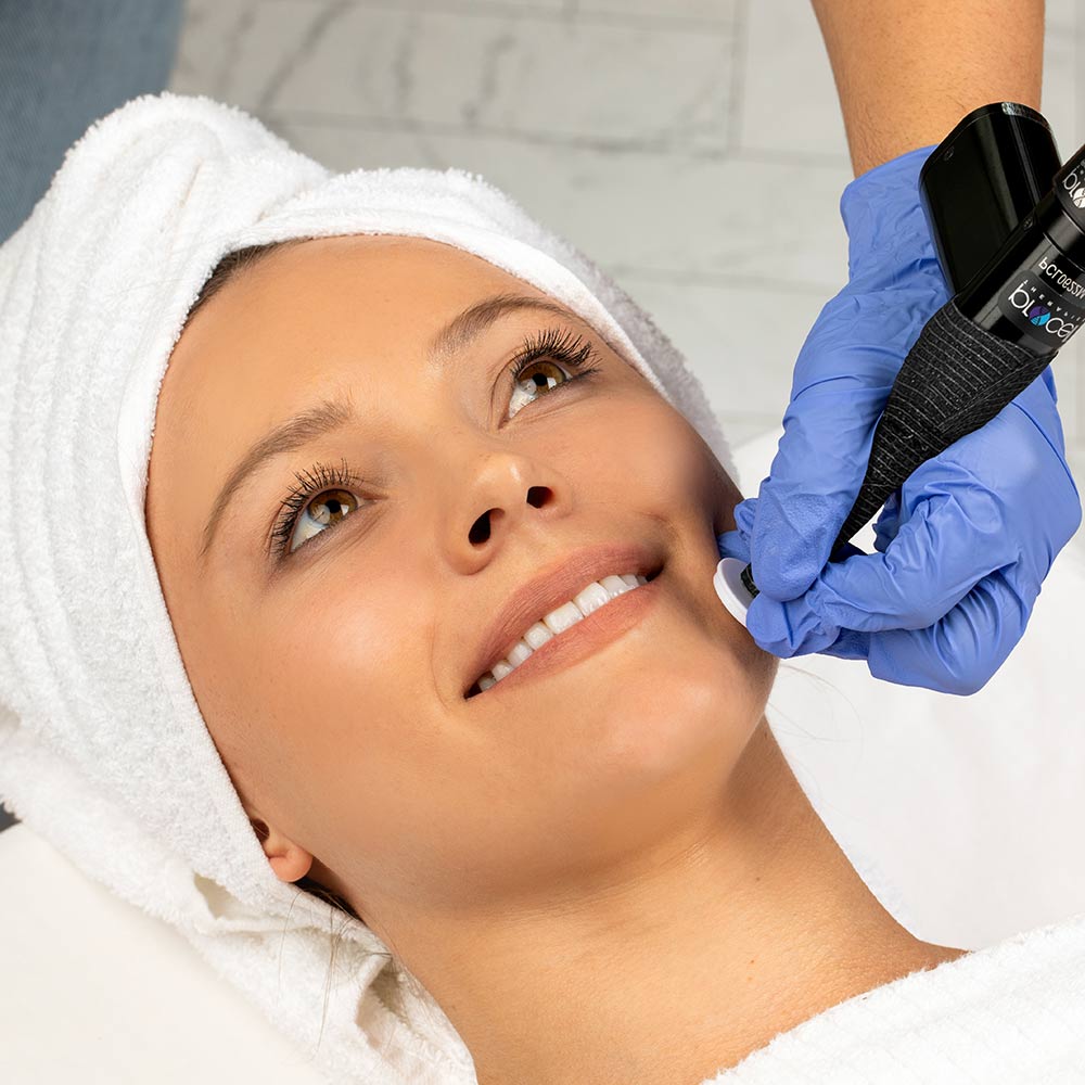 Procell skin treatments Cottonwood AZ